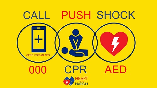 call push shock